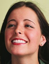 A woman smiles after having a dental bonding treatment